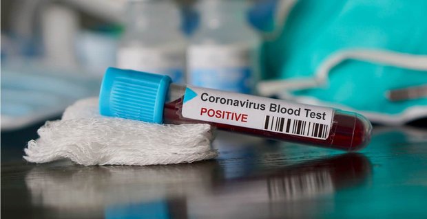 5 porad dotyczących randek podczas pandemii koronawirusa